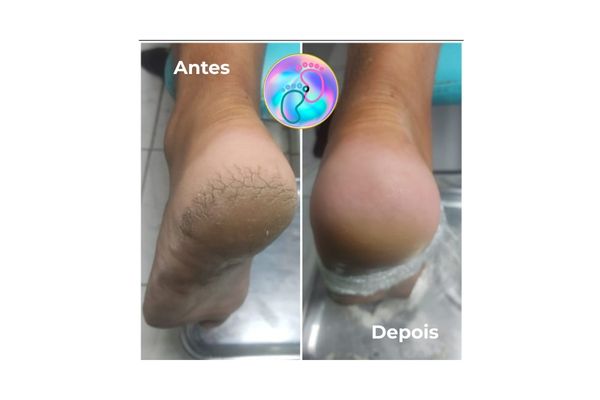 Foto de antes e depois do tratamento 36